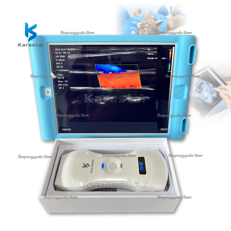 Medical Ultrasound Wireless 3 in 1 Handheld 192 Elements Vet Ultrasound Machine Convex And Linear Wireless Ultrasound