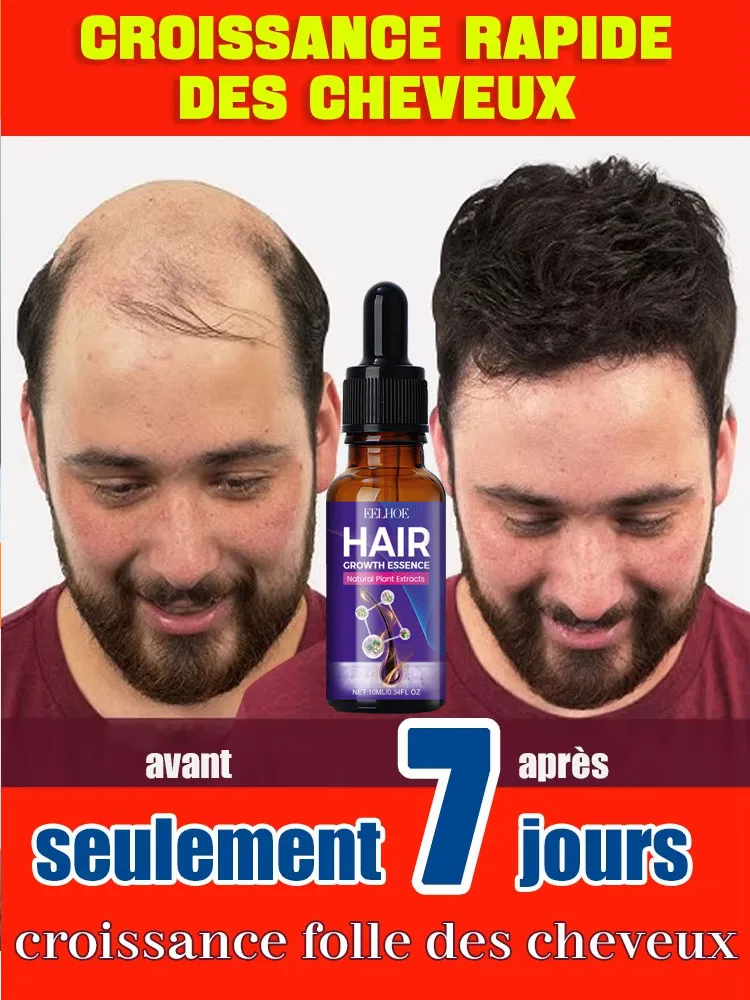 

98% of buyers buy again, have more and more hair, say goodbye to baldness, thick hair,Hot selling product.