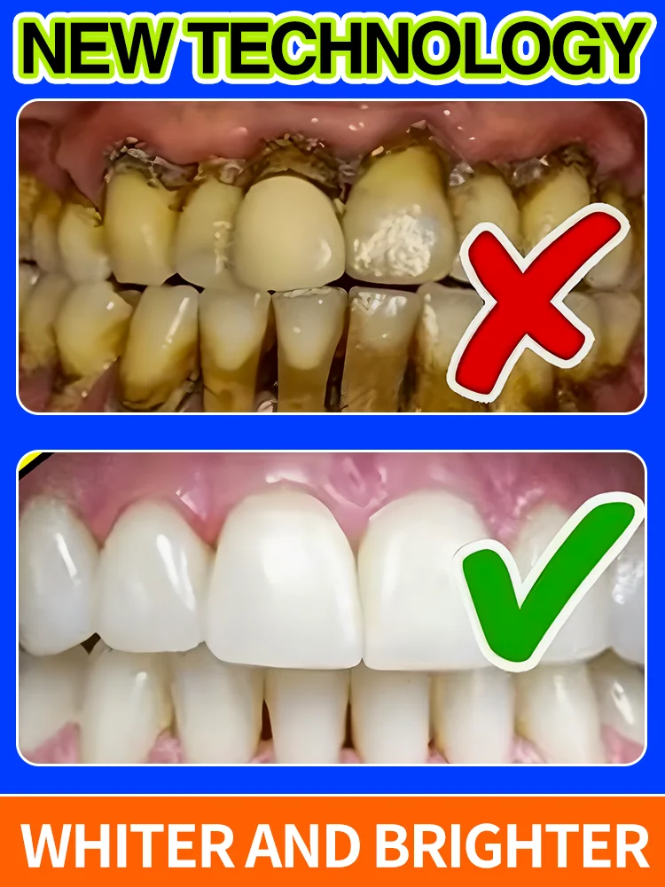 

7-day teeth whitening mousse Oral Care Fresh Breath Dental Calculus Remover