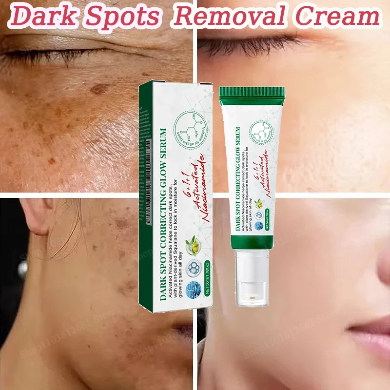 

Удаление темных пятен Удаление мелазмы Меланин Осветление прыщей Антивозрастные веснушки на лице Коррекция меланина Ниацинамид Отбеливание