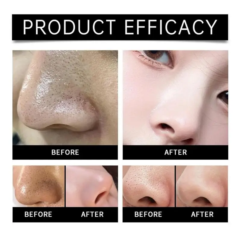 女性用鼻孔拡張テープ,ディープクリーニング用鼻孔拡張パッチ,にきび除去用鼻孔拡張