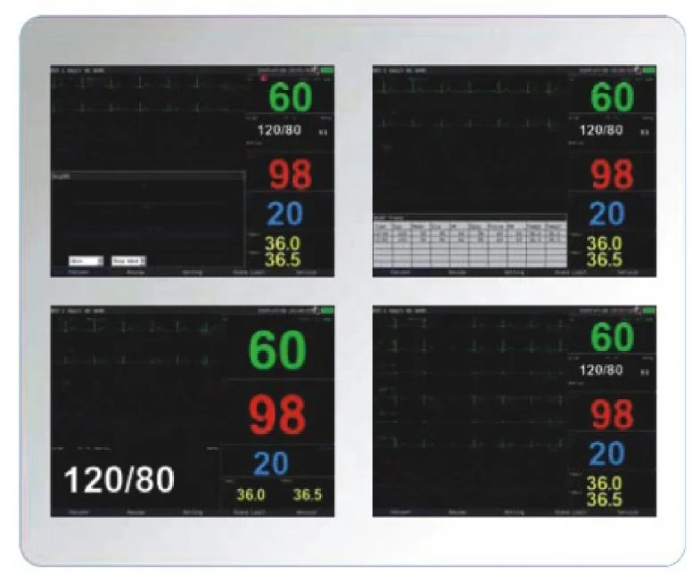 

15-дюймовый многопараметрический ветеринарный пациент, 15-дюймовый пациент