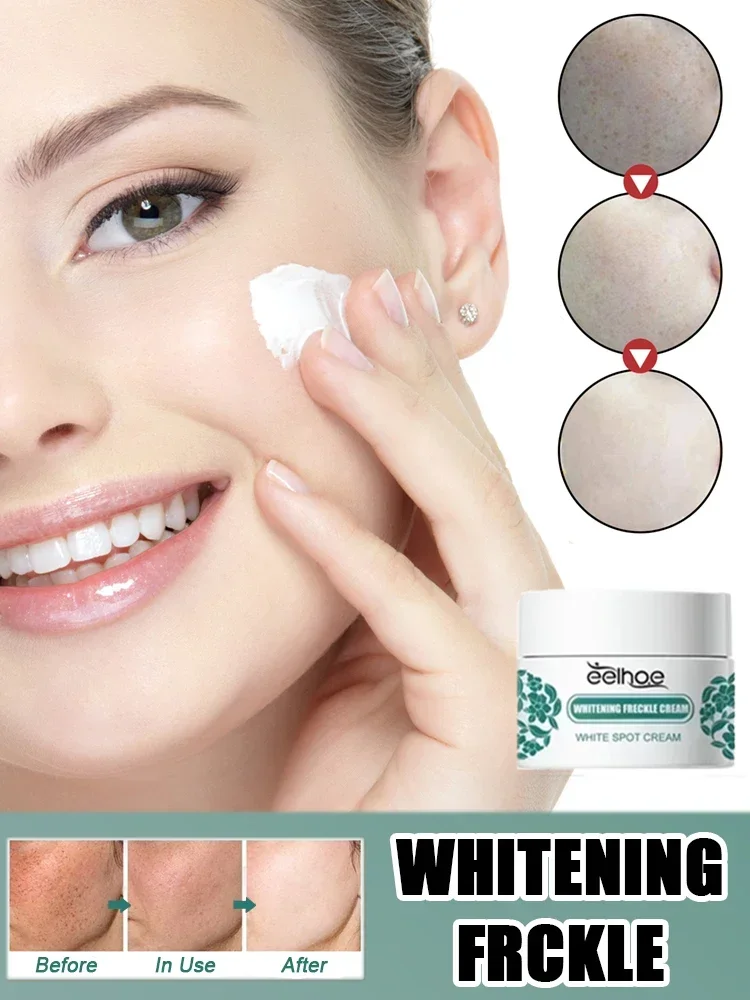 

Removal Dark Spots Freckles Brighten Facial Skin Firming Whitening Frckle Products Reduce Melanin Lighten Dark Skin