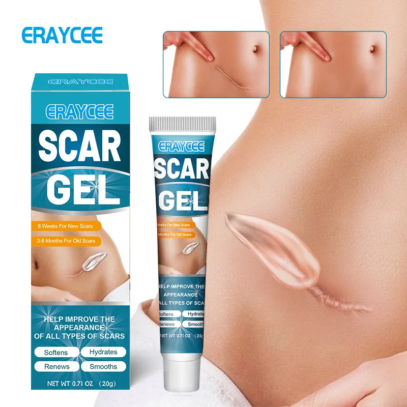 ERAYCEE-gel para cicatrices finas, cuidado de la piel abdominal, quemadura, superventas