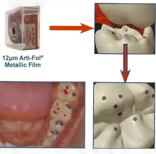 

Bausch Dental Arti-Fol Metallic Articulating Paper 12μm Dental Materials Shimstock Film 20 Meters BK28/31/32/39 Metallic Film
