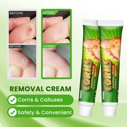 30g Foot Corn Remover Cream Chicken Eye Skin Infection Treatment Ointment Foot Care Dead Skin Removal Personal Health Care