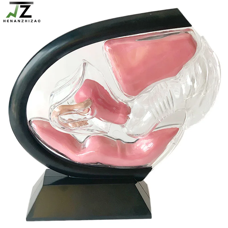 Medical Female Transparent Uterus Model Gynecological Demonstration Education