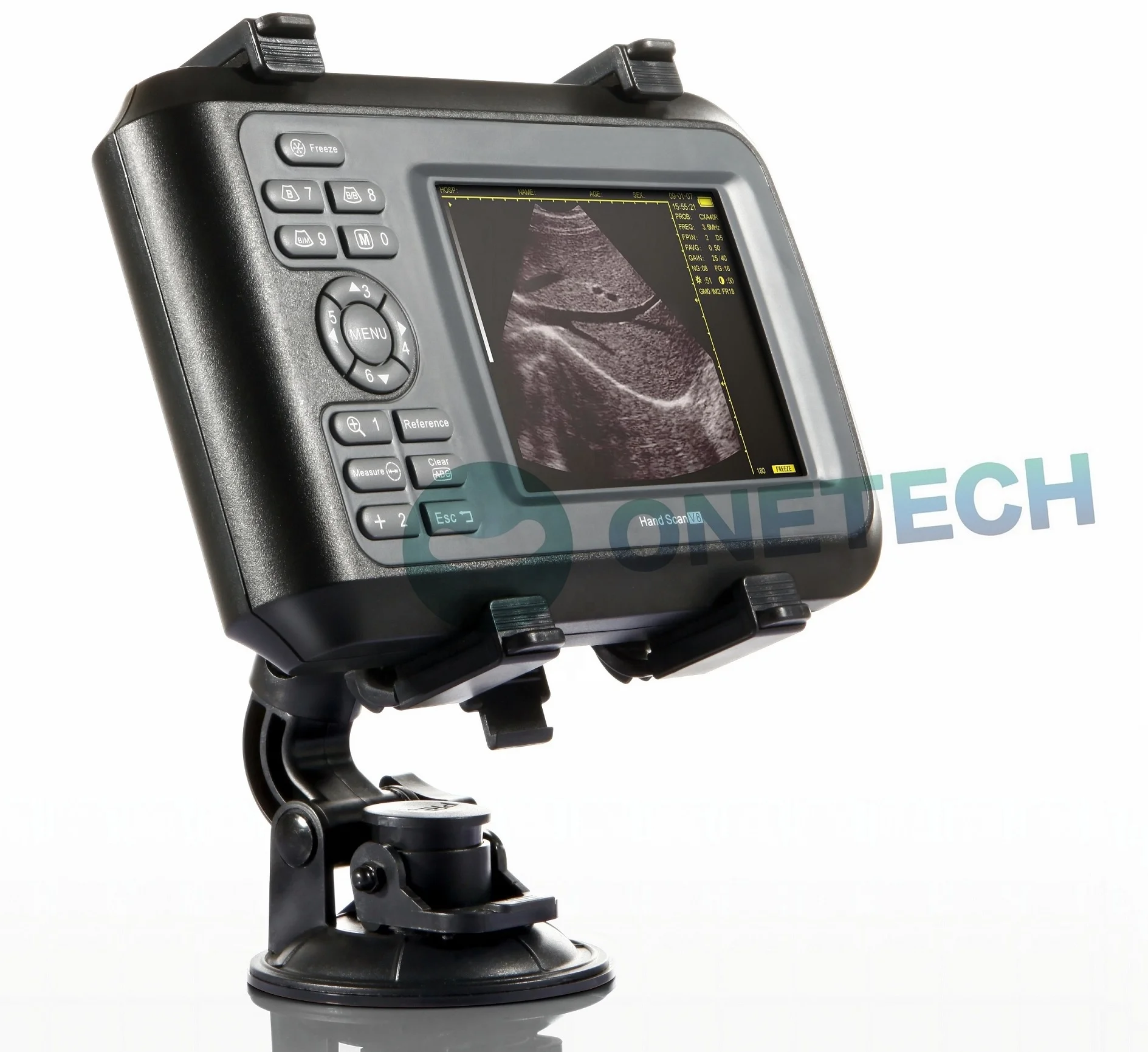 Handheld Scanner Veterinário para Animais, Scanner LCD, V6 Grande Promoção, 5.5"
