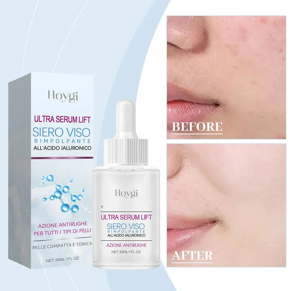 

30ml Hyaluronic Acid Facial Essence Deep Moisturizing Korean Repair Skin Care Essence Skin Facial Products Skin Anti-aging O7P4