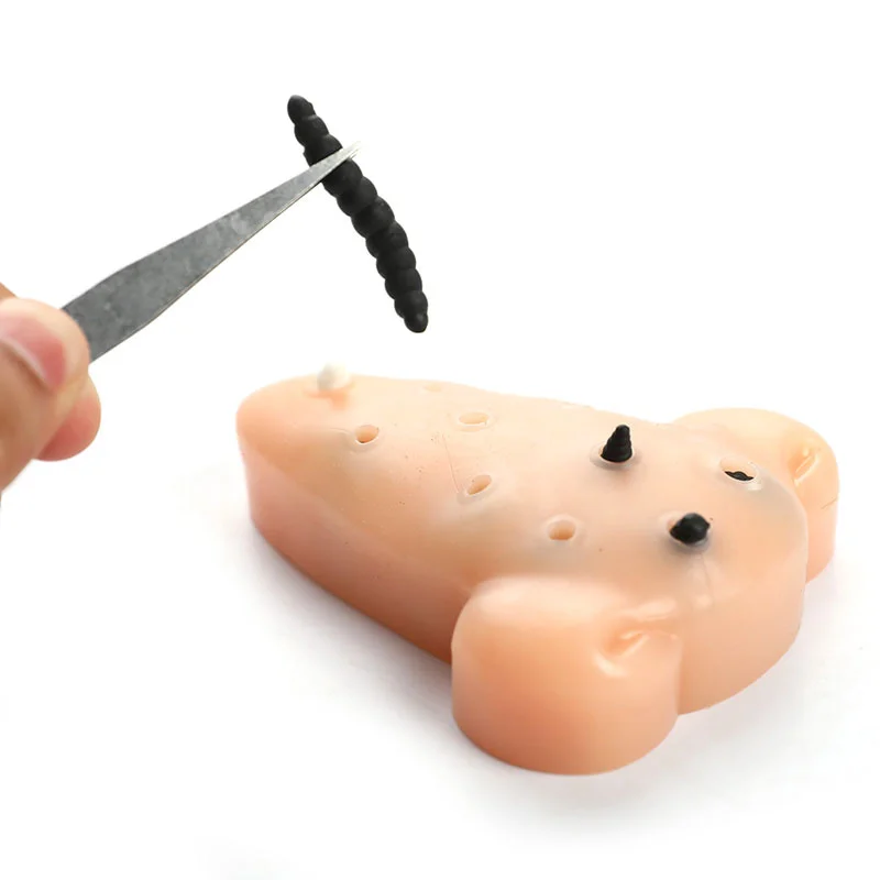 Blackhead Shape Pimple Toys Squeeze Acne Stress Relief Toys Remover Stop Toys