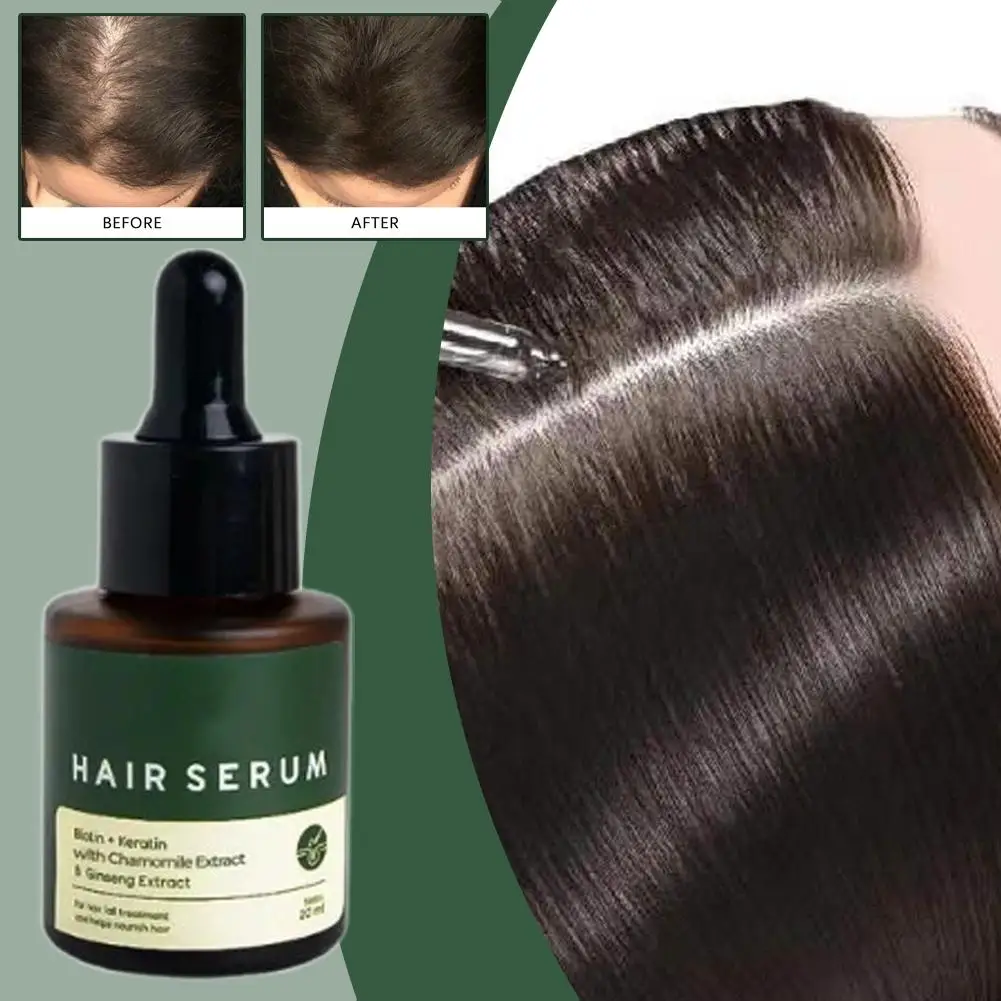 مغذي للعناية بالشعر، ظروف الزيوت العطرية، شعر فروة الرأس يقلل من التجعد، 20 مل، جذور الشعر W8G4 #3