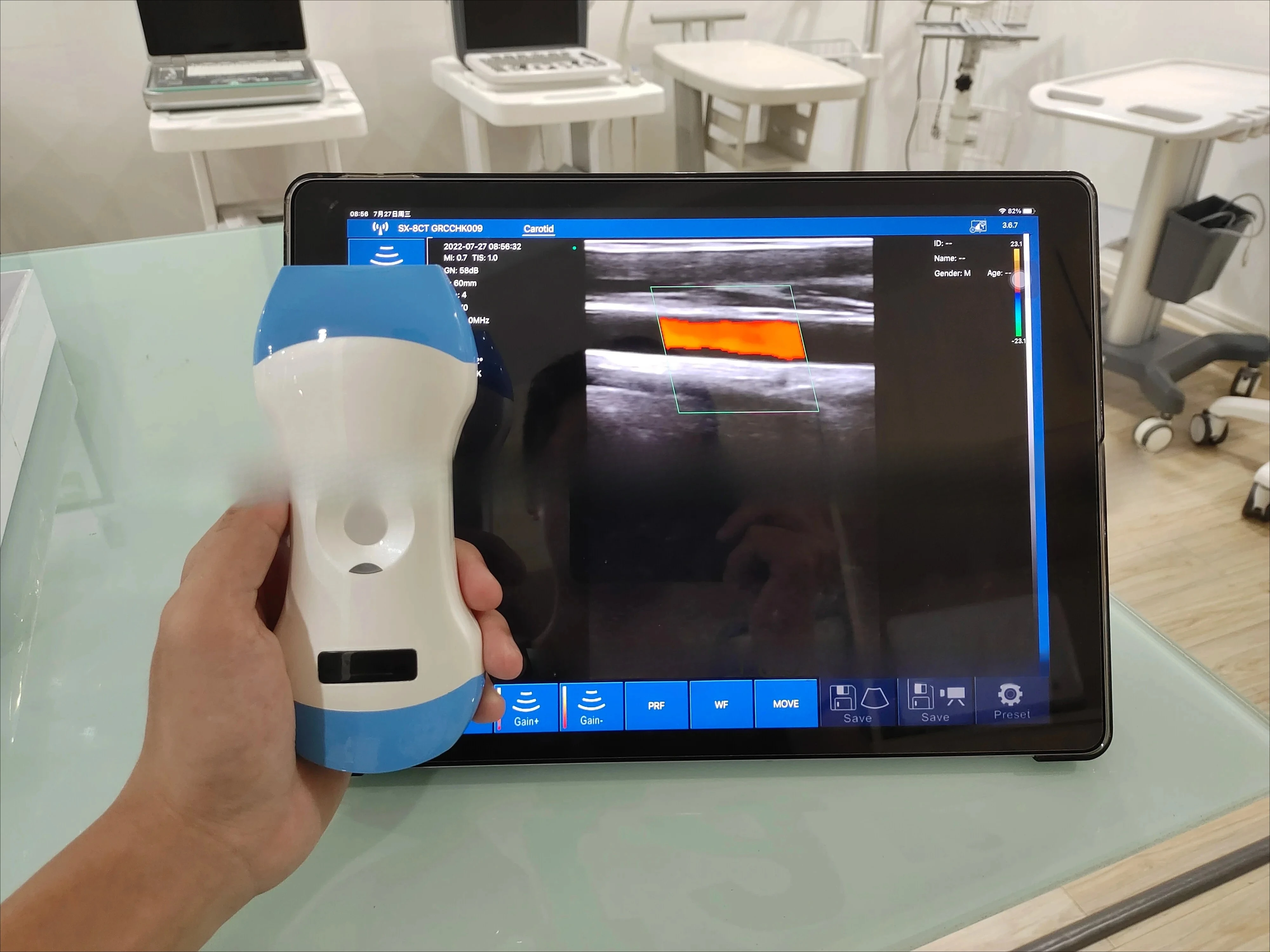 CHKJ 3-in-1 Wireless Scanner with Convex Probe B/B/M/CF/PW/PD Mode
