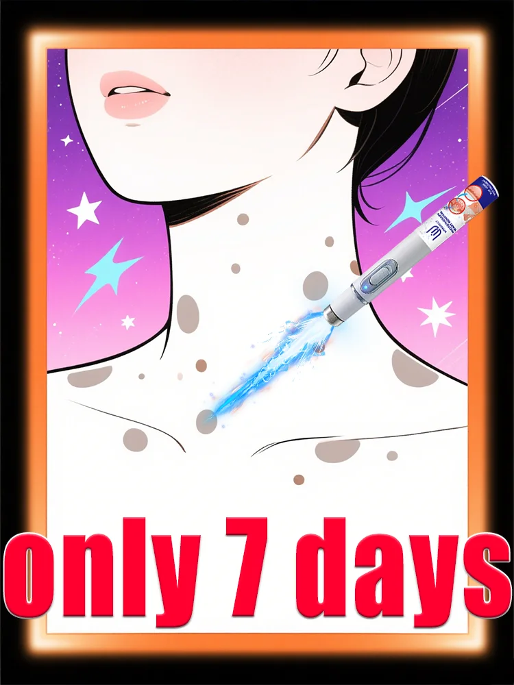 

Generation-2 laser says goodbye to all warts in 7 days