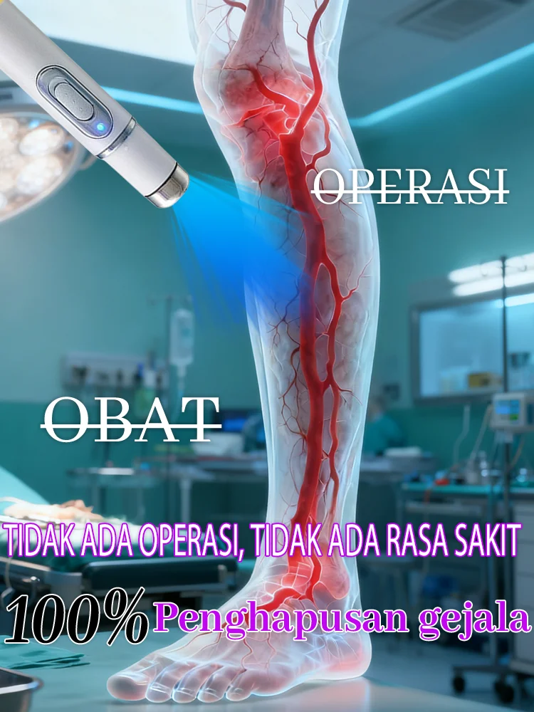 

Varicose Veins Treatment Device - Relieves Leg Swelling Pain & Visible Veins Fast