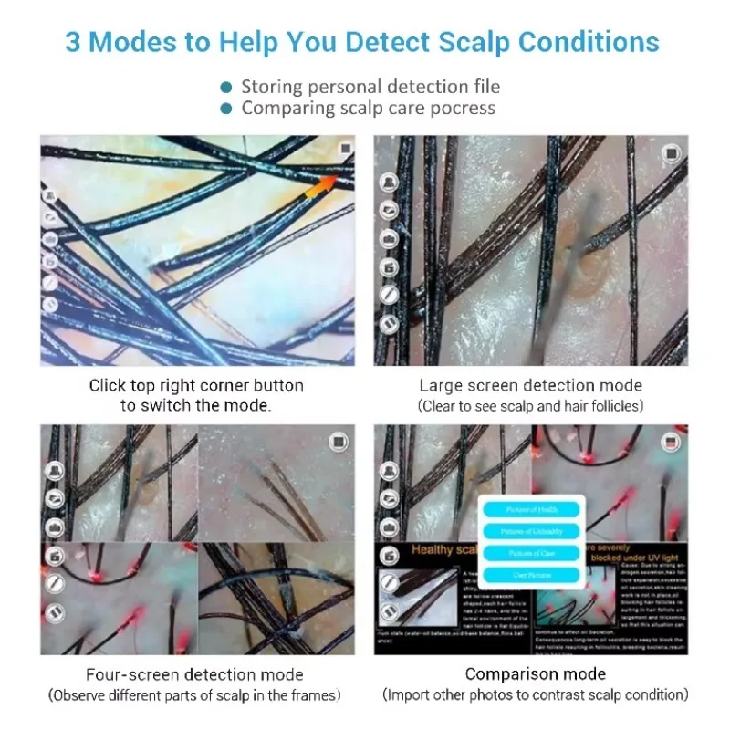 เครื่องวิเคราะห์หนังศีรษะและผิวหน้า 2 in 1 เทคโนโลยีใหม่ล่าสุด พร้อมระบบสแกน 3 มิติ AI