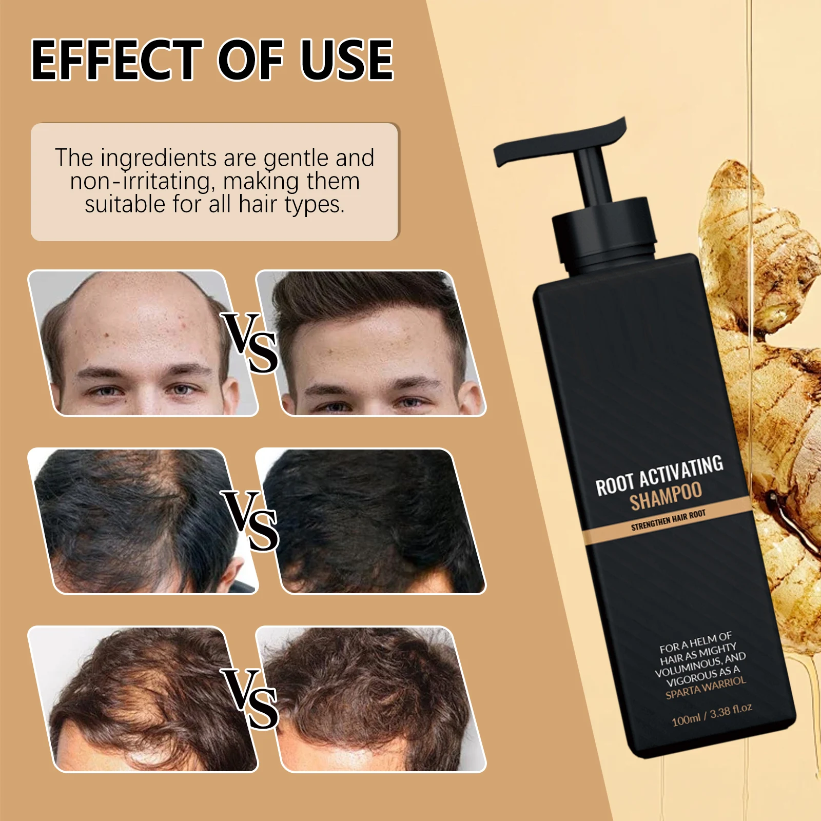 Volumengebendes Kopfhautpflege-Shampoo, Tiefenreinigung, Ingwer-Extrakt, natürliche Formel, Haarstärkung, nährend für fettiges Haar, alle Typen – Detail 5