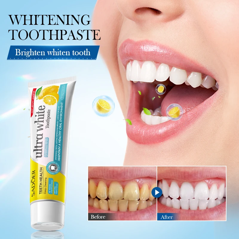 100g Natural Whitening Lemon Toothpaste Removing Yellowing Bad Breath Tooth Decay Fresh Breath Dental Cream Oral Cleansing Care