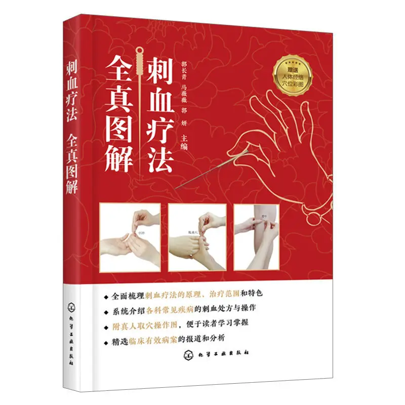 complete-picture-of-blood-pricking-therapy-book-of-blood-pricking-therapy-complete-book-of-blood-pricking-therapy-in-china