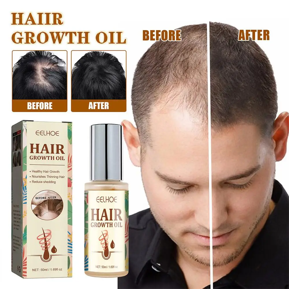 

Anti-hair Loss Hair Oil Repair Dryness Natural Nourishing Scalp Promote Hair Care Serum For Men Women D7e1