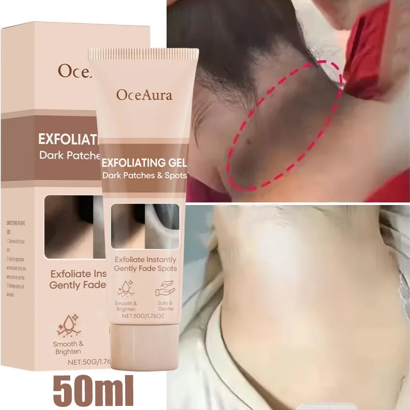 

Remove Melanin Nicotinamide Brightening Cream For Dark Skin Effective Lighten Thigh Inner Bleach Private Parts Brighten Cream