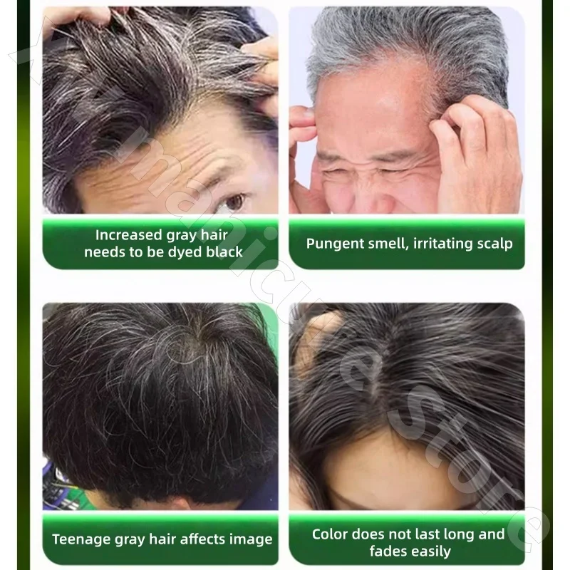 Dong Miao Hair Dye Cream Non-stick Scalp Tong Dye Covers Gray Hair Gentle Plant Extract Bubble Hair Dye 30ml*10 Bags