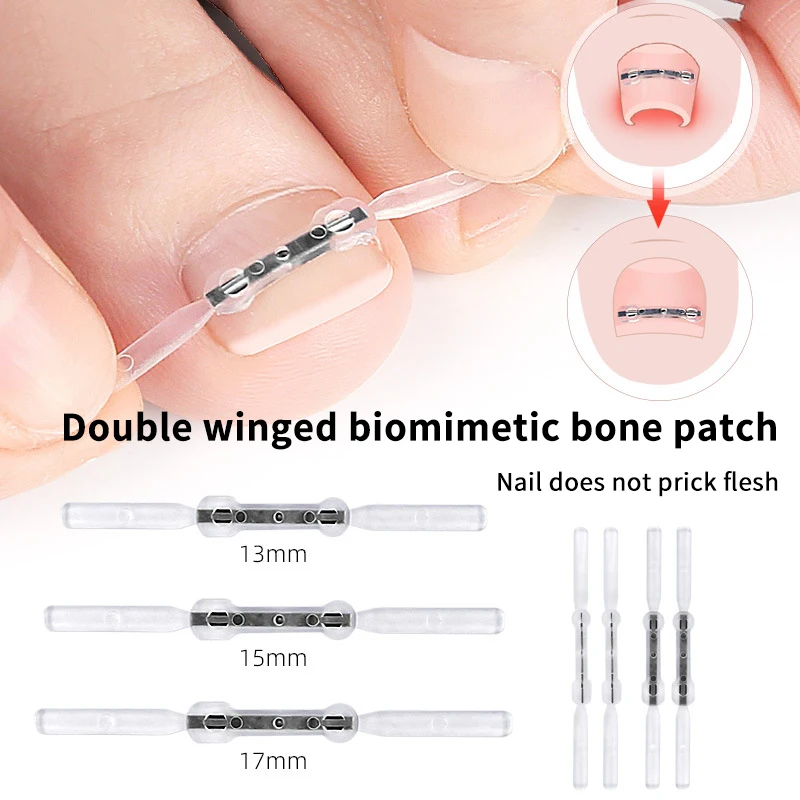 2 pçs adesivos de correção de unhas elástico encravado corretor de unhas remendos adesivo auxiliar invisível tratamento paroníquia recuperar