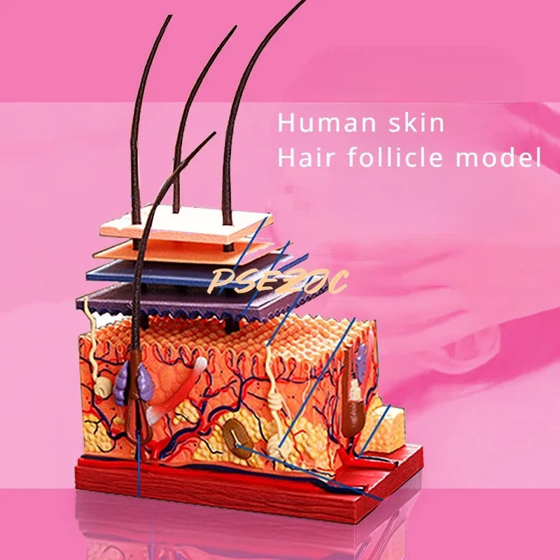 4D Medical Teaching Plastic Adhesive Human Skin Structure Anatomical Assembly Model Scalp Hair Follicle Supplies