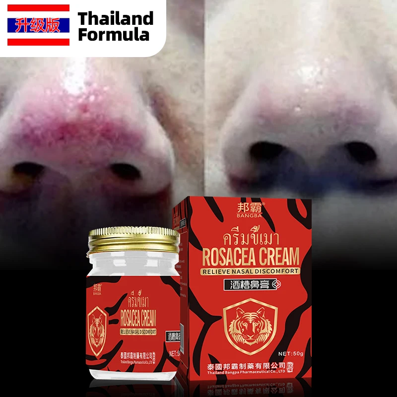 Rosacea Treatment Cream Skin Care Anti Nose Mites Red Nose Repair Face Shrink Pores Blackhead Acne Remover Thailand Formula