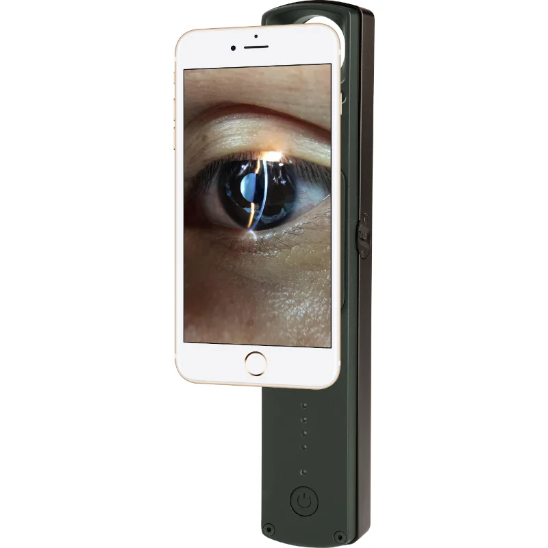 S-150 Hand-held slit lamp veterinary equipment portable slit lamp other veterinary instrument eye testing use with smartphone