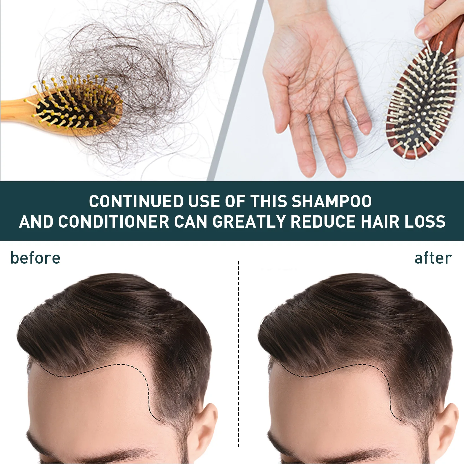 2pcsx100ml Hair Growth Shampoo - огляд і ціна Hair Care Natural Ingredients