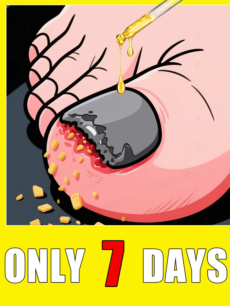 

Tᴏᴇɴᴀɪʟ Fᴜɴɢᴜs Pᴀᴛᴄʜᴇs Rᴇᴘᴀɪʀ Dɪsᴄᴏʟᴏʀᴇᴅ Dᴀᴍᴀɢᴇᴅ Nᴀɪʟs Fᴏᴏᴛ Cᴀʀᴇ2025