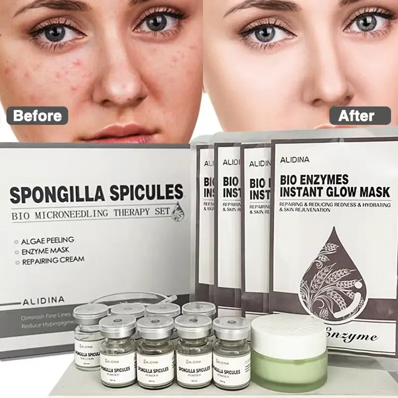 Set de Reparación y Rejuvenecimiento con Espículas de Esponja ZS Effective para Melasma/Hiperpigmentación/Cicatrices Post-Acné, Microagujas Bio Líquidas