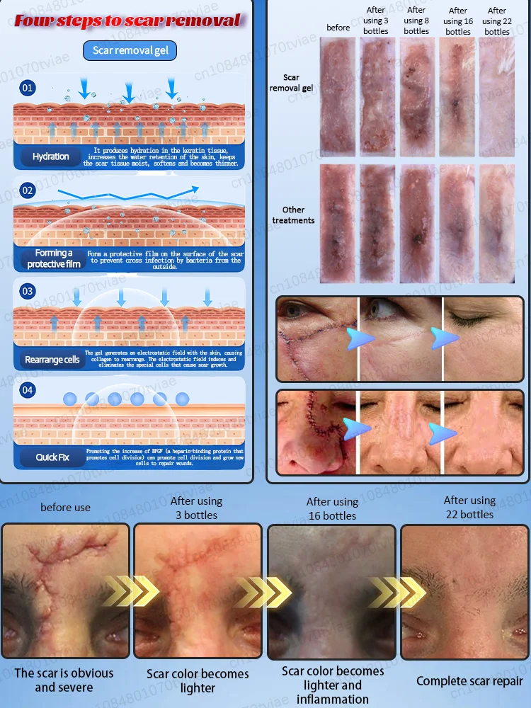 Zorg voor je littekens en laat het ze helpen oplossen