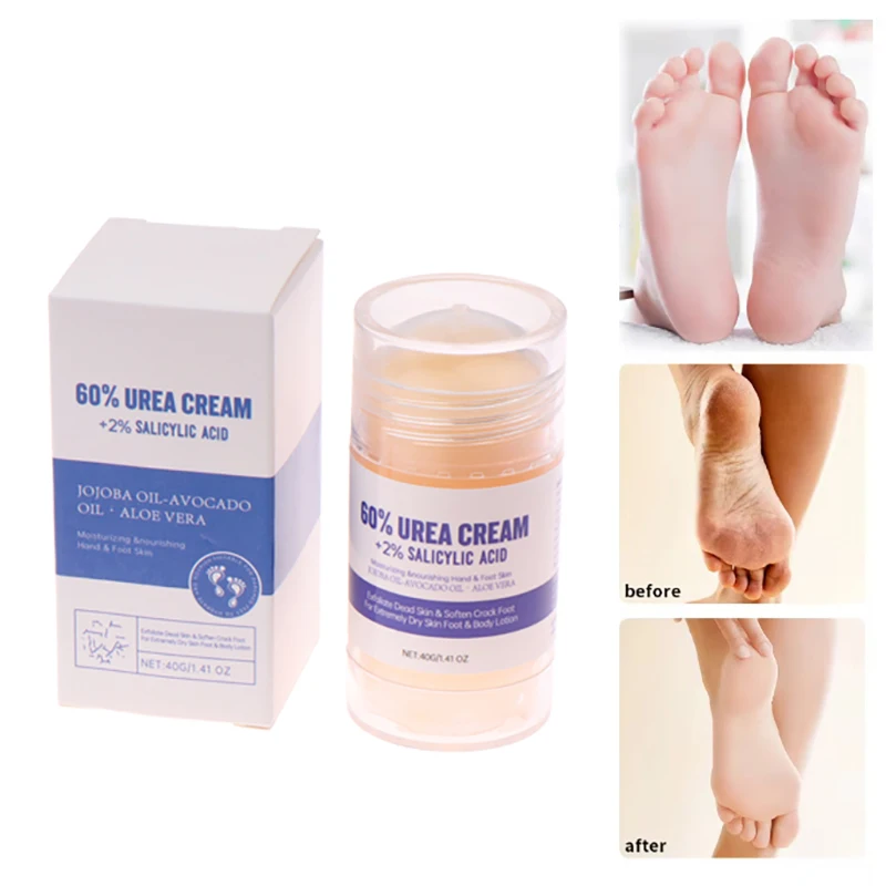 40g Ultra-Hydrating Foot Cream Anti-Drying Crack Removal Dead Moisturizing Skin Hand Feet Care Softening Calluses Cracked Mask