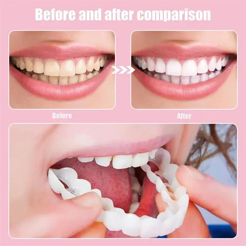 

1 set Reusable Snap On Teeth Whiten Cover Anti-grinding Perfect Fit Silicone Smile Teeth Veneers Teeth Upper Beauty Cosmetics