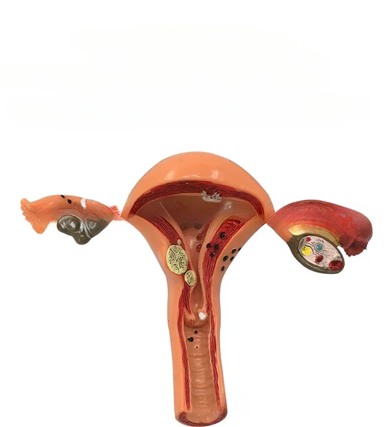 Human uterus model teaching aids mold vagina ovarian anatomy pathology medicine female simulation female reproductive model