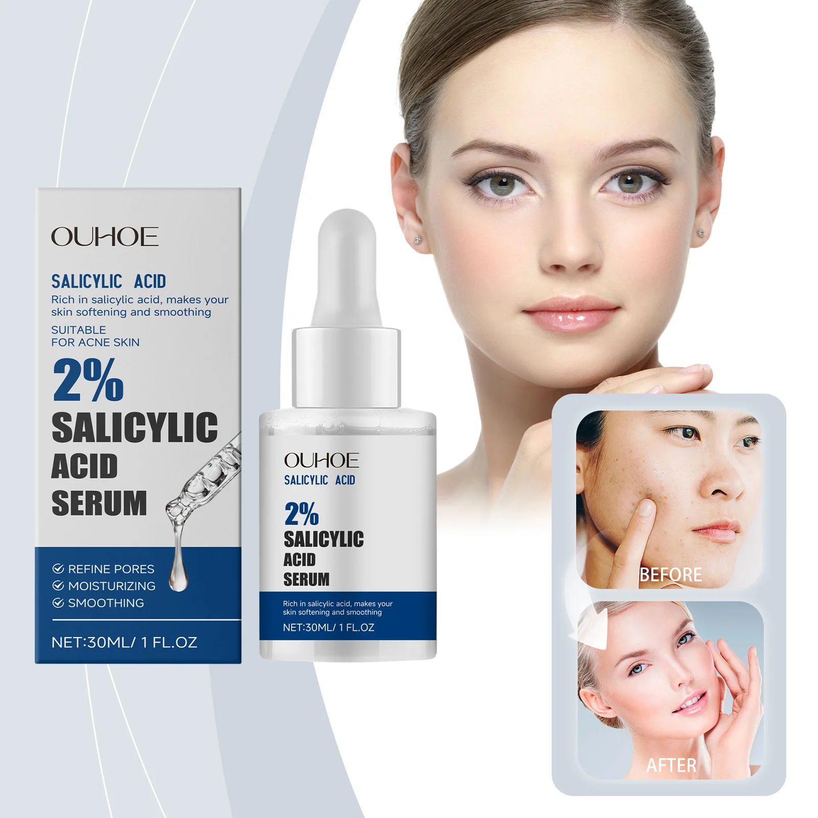 

Сыворотка для лечения прыщей — нежная, питательная, для минимизирования пор и контроля пятен, эссенция для лица для жирной кожи, ухода за кожей против прыщей