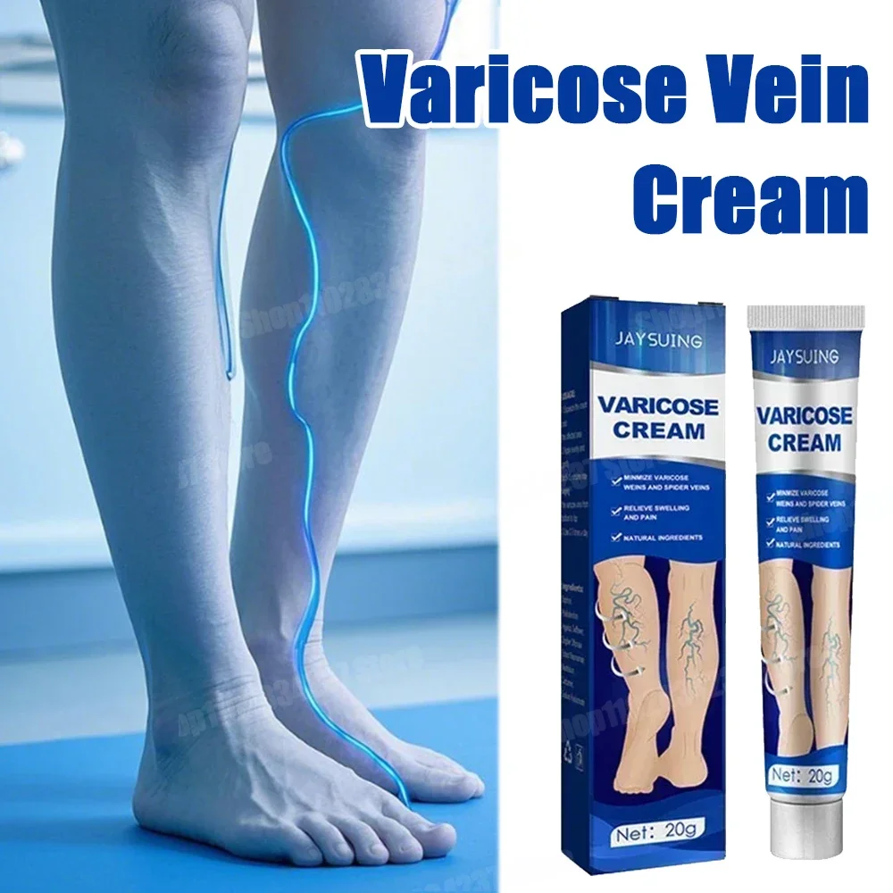 Varicose Veins and Spider Legs Repair Cream Soothes Pain and Enhances Skin Elasticity Solve Foot Skin Problems