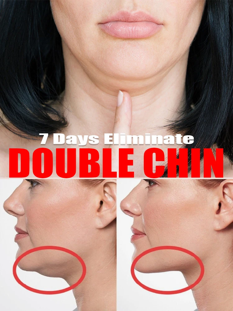 

V face cream double chin elimination V line