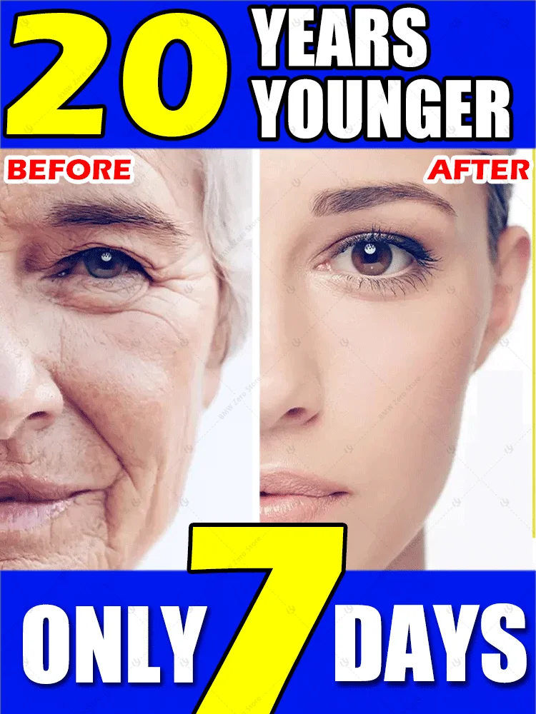 

Wrinkles Free, Science of Youth
