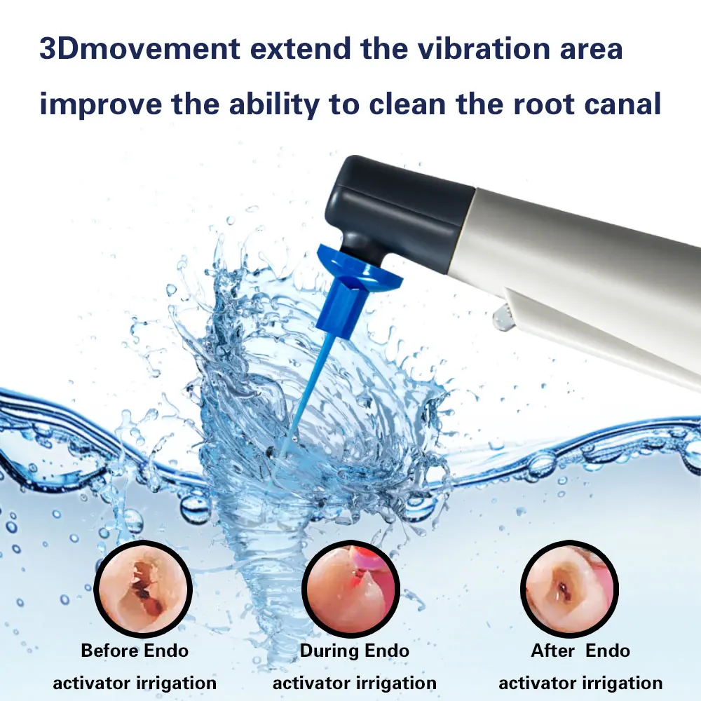 Xnd ativador endodôntico dental com luz led odontologia raiz canal sonic irrigador com 60 peças dicas endo ativador