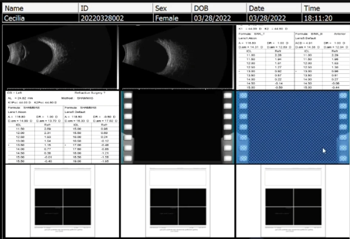 ESCÁNER A/B ULTRASÓNICO MD-2300S-AB para OPHTHALMOLOGÍA