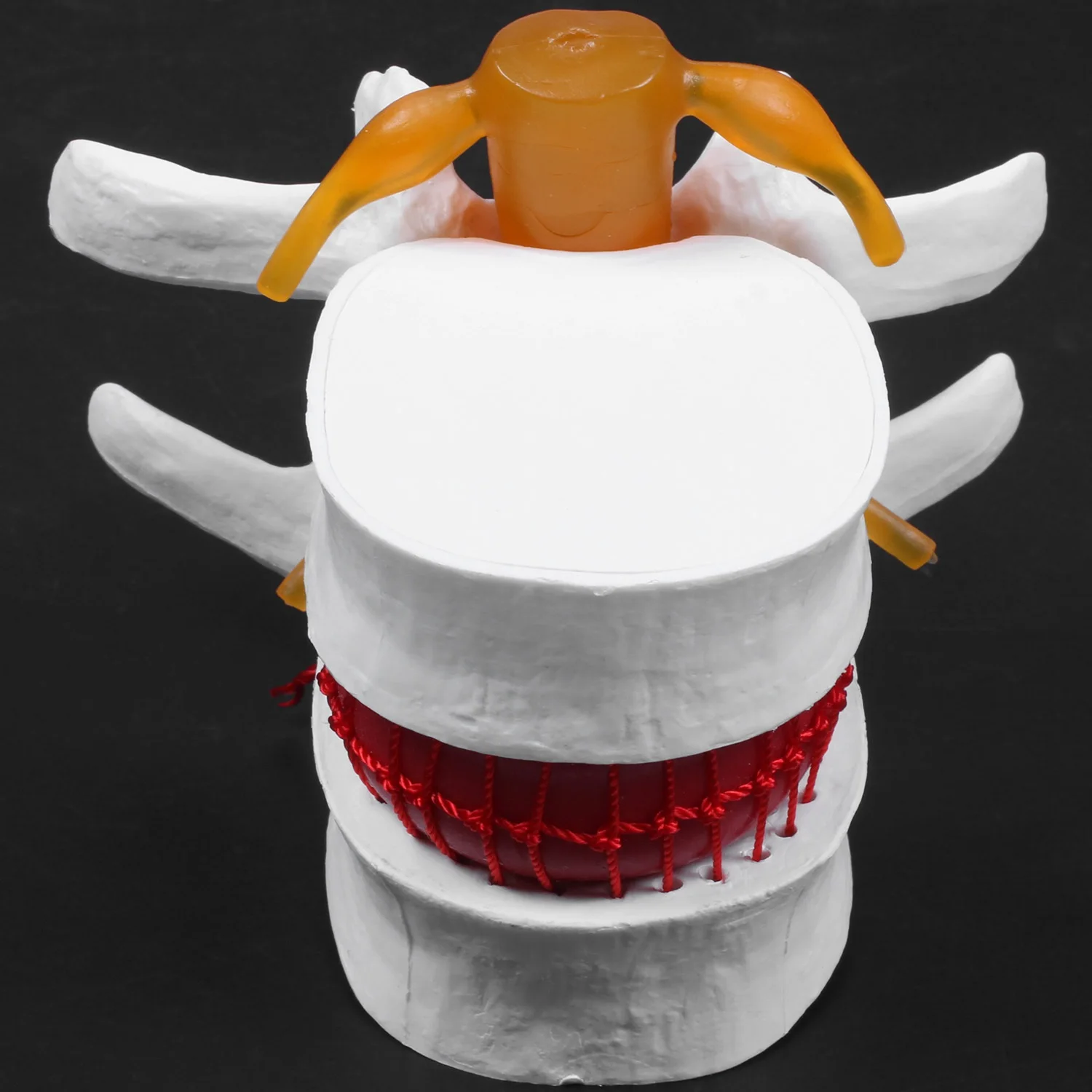 Esqueleto de anatomía humana, columna vertebral, hernia de disco Lumbar, modelo de enseñanza, cráneo cerebral, suministros escolares traumáticos, instrumento