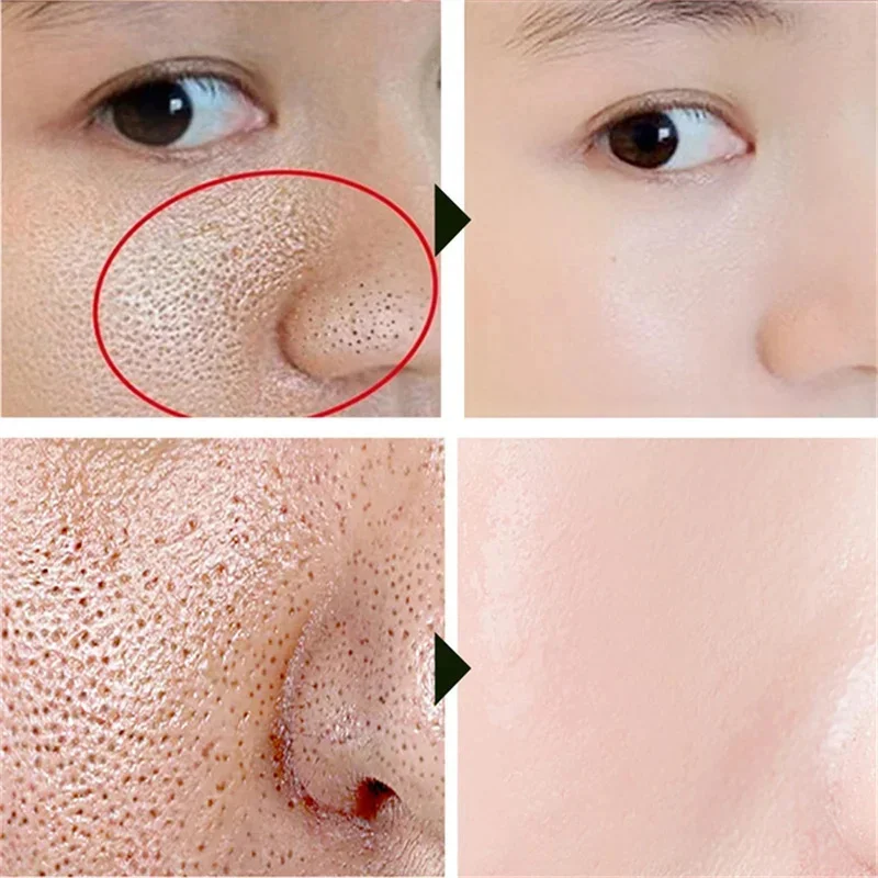 Crème de rétrécissement des pores à l'acide salicVAC, élimination rapide des grands pores, élimine les points noirs, resserre le visage, lisse la peau, produit de soin coréen