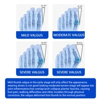 Bunion Adjuster Knob Adjustable Foot Hallux Valgus Braces Toe Straightener Pedicure Finger Toe Adjuster Unisex 4