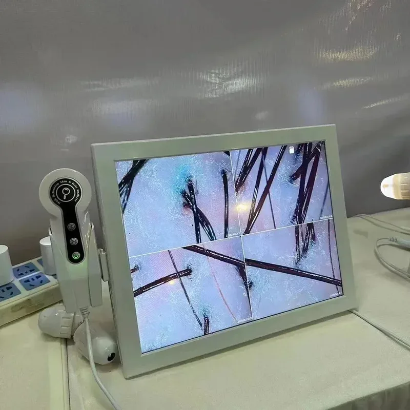

2026 HD Digital Skin Analyzer Professional Hair Scalp Camera Detector Hair Follicle Oil Moisture Test Device 15 inches