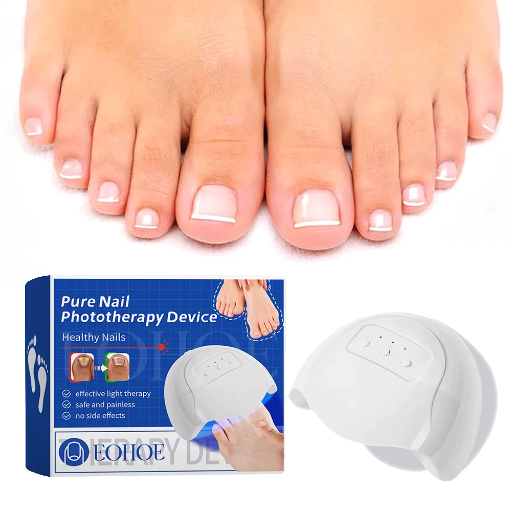 Nail Fungus Cleaning  Device Effective Home Use Nail-Fungus Remover Nail Fungus  Therapy Device for Onychomycosis