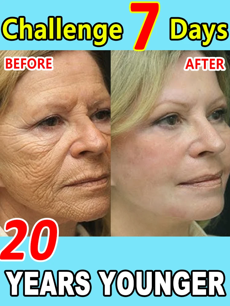 

100% wrinkles disappear,Care for women's and men's skin