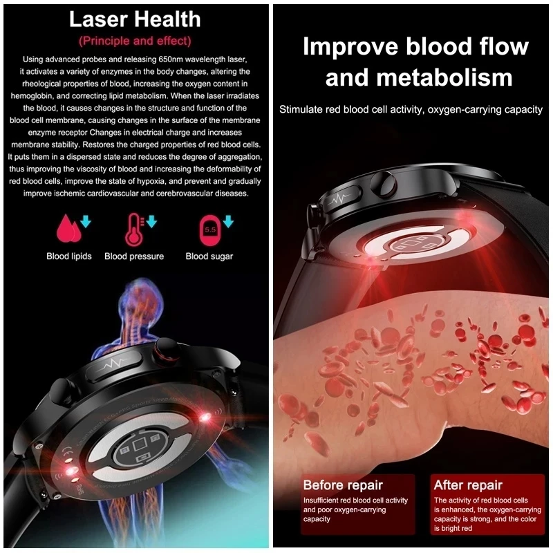 2024 New Men Iaser Therapy Noninvasive blood glucose blood fat Smart Watch Uric Acid ECG+PPG Bluetooth Call Health Smartwatch