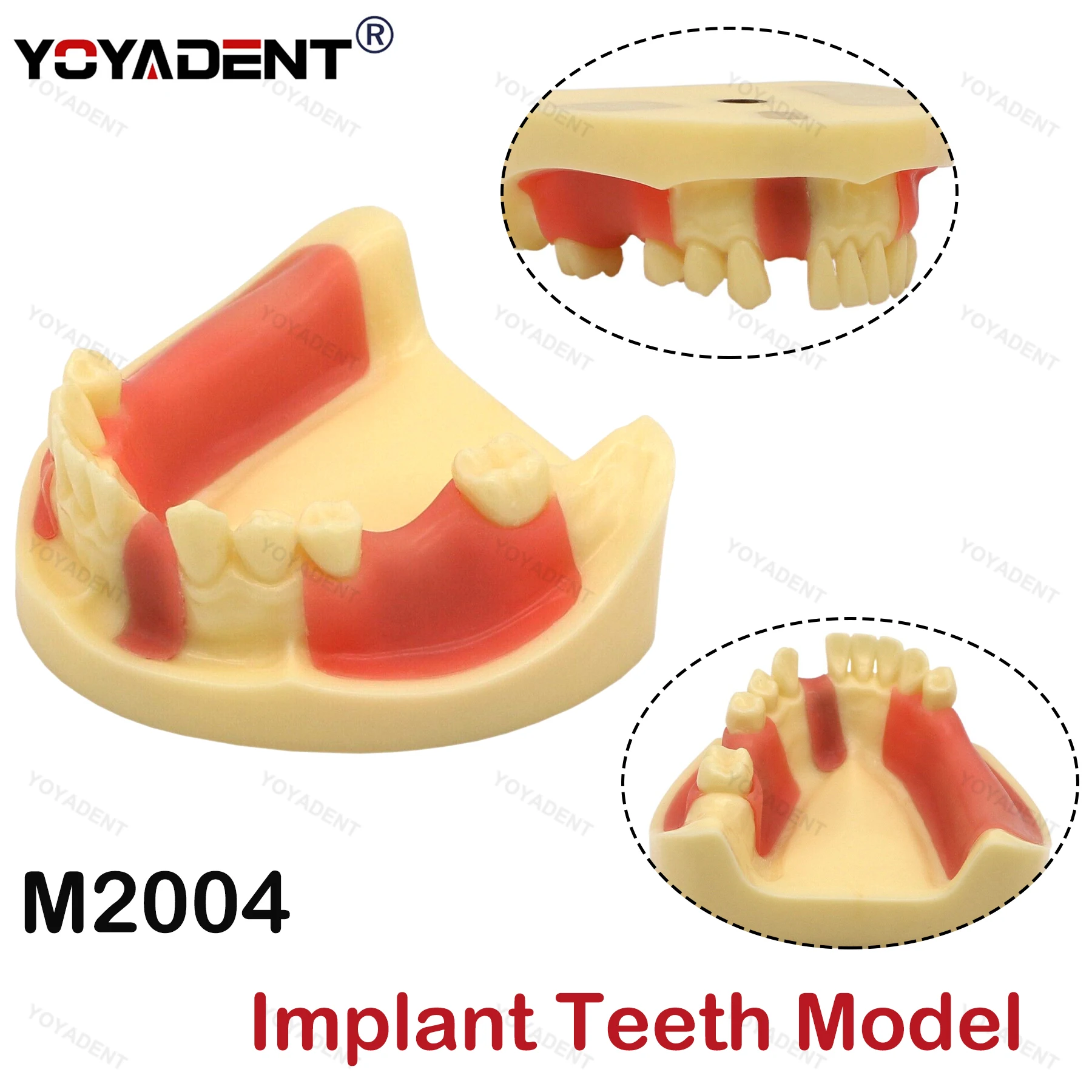 

Dental Teeth Model Gingiva Removable Implant Drilling Practice Teeth Model For Patient Education Demo Student Training